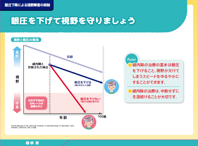 眼圧を下げて視野を守りましょう